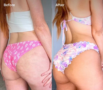 AuraSpace™ Body Lymphatic Massager